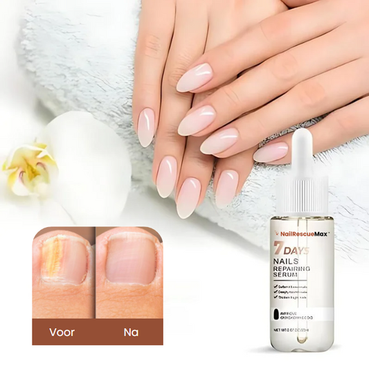 NailRescueMax™ Geavanceerde Nagelherstel | 99% Gezondere Nagels in 7 Dagen!